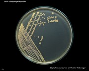 mueller hinton agar with staphylococcus